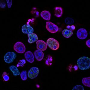 Photo of dyed cells - sourced from National Cancer Institute